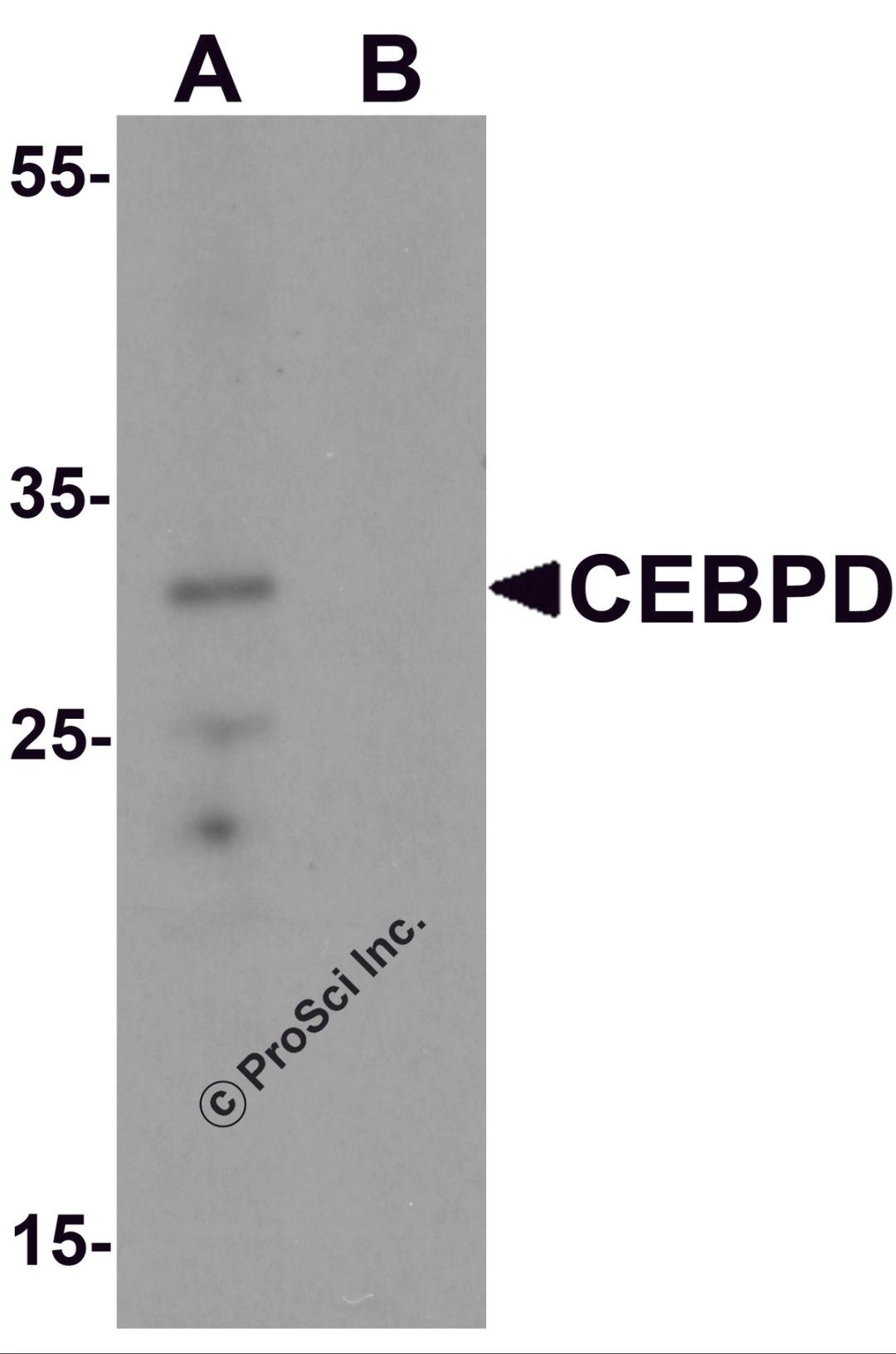 Western blot analysis of CEBPD in rat spleen tissue lysate with CEBPD antibody at 0.5 μg/mL in (A) the absence and (B) the presence of blocking peptide.