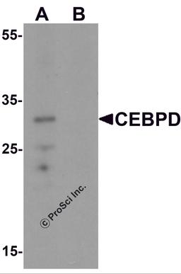 Western blot analysis of CEBPD in rat spleen tissue lysate with CEBPD antibody at 0.5 μg/mL in (A) the absence and (B) the presence of blocking peptide.