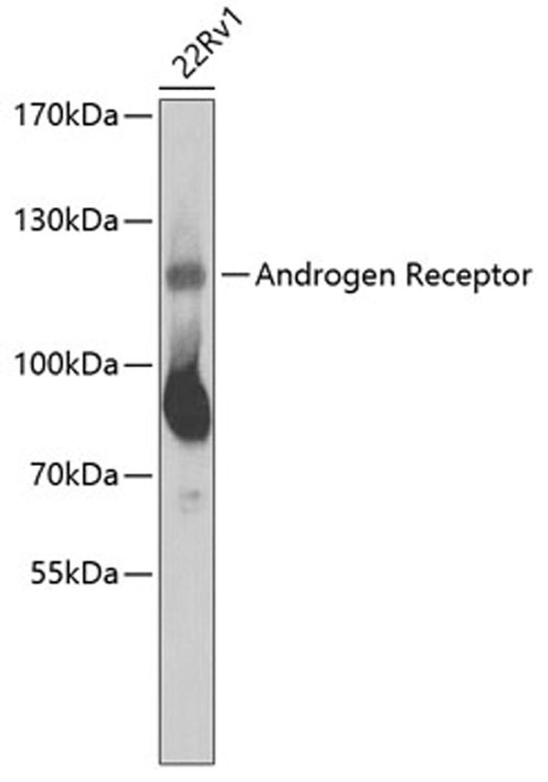 Western blot - Androgen Receptor Antibody (A2053)