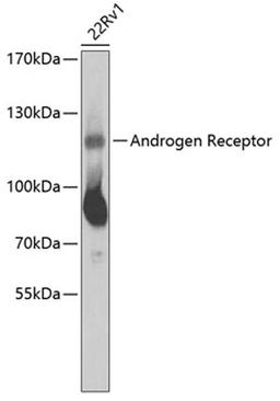 Western blot - Androgen Receptor Antibody (A2053)