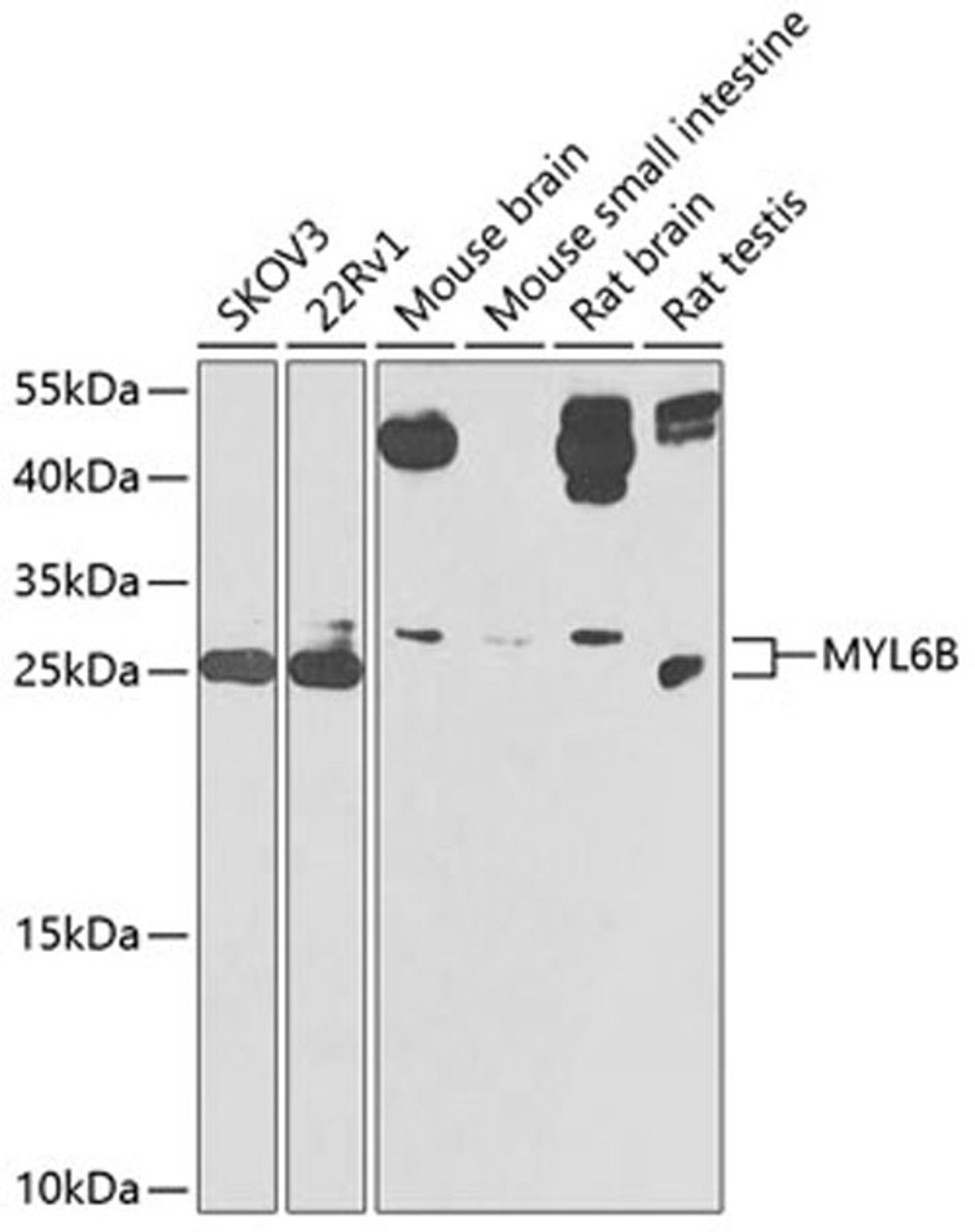 Western blot - MYL6B antibody (A9996)