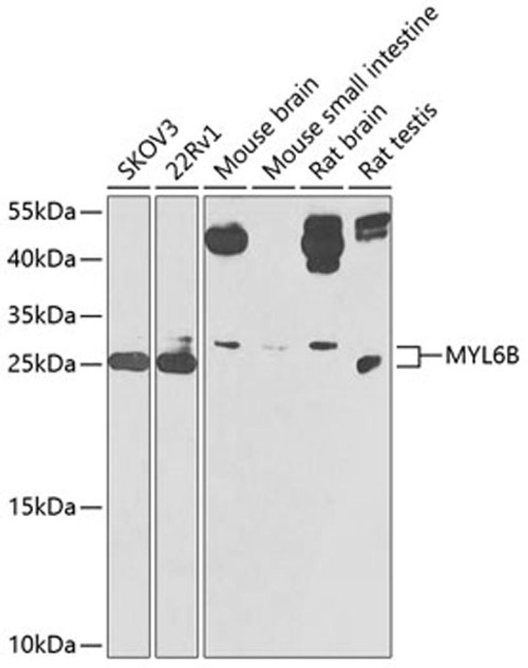 Western blot - MYL6B antibody (A9996)