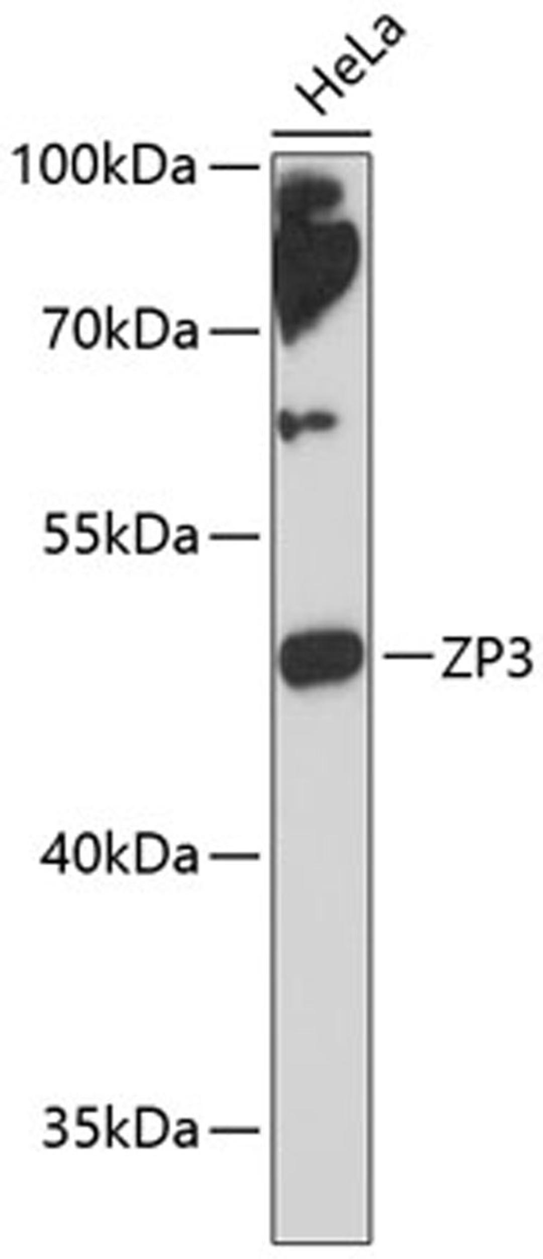 Western blot - ZP3 antibody (A13156)