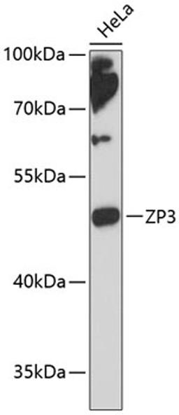 Western blot - ZP3 antibody (A13156)