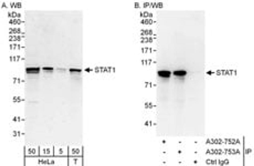 Detection of human STAT1 by western blot and immunoprecipitation.