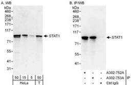 Detection of human STAT1 by western blot and immunoprecipitation.