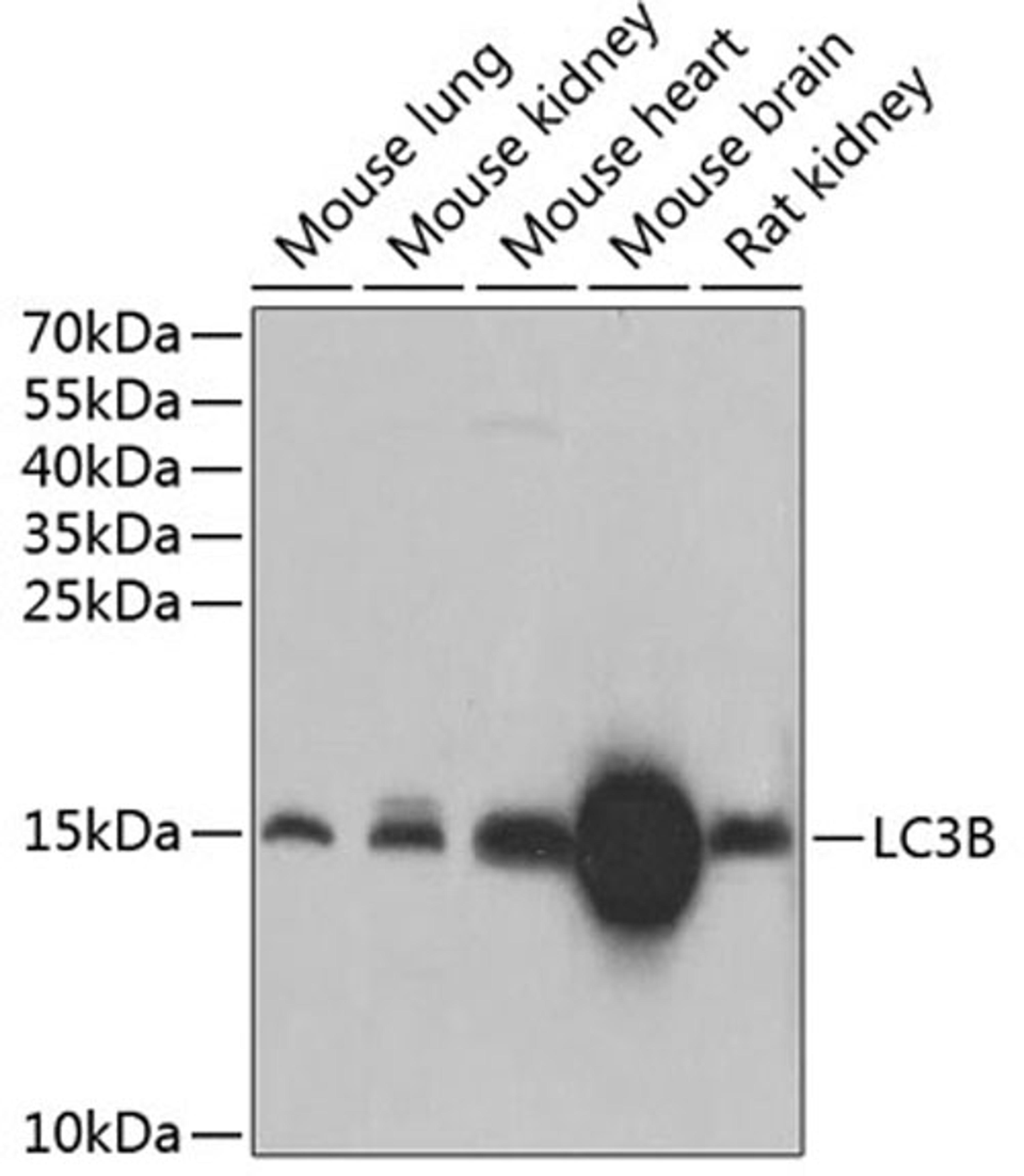 Western blot - LC3B antibody (A11280)