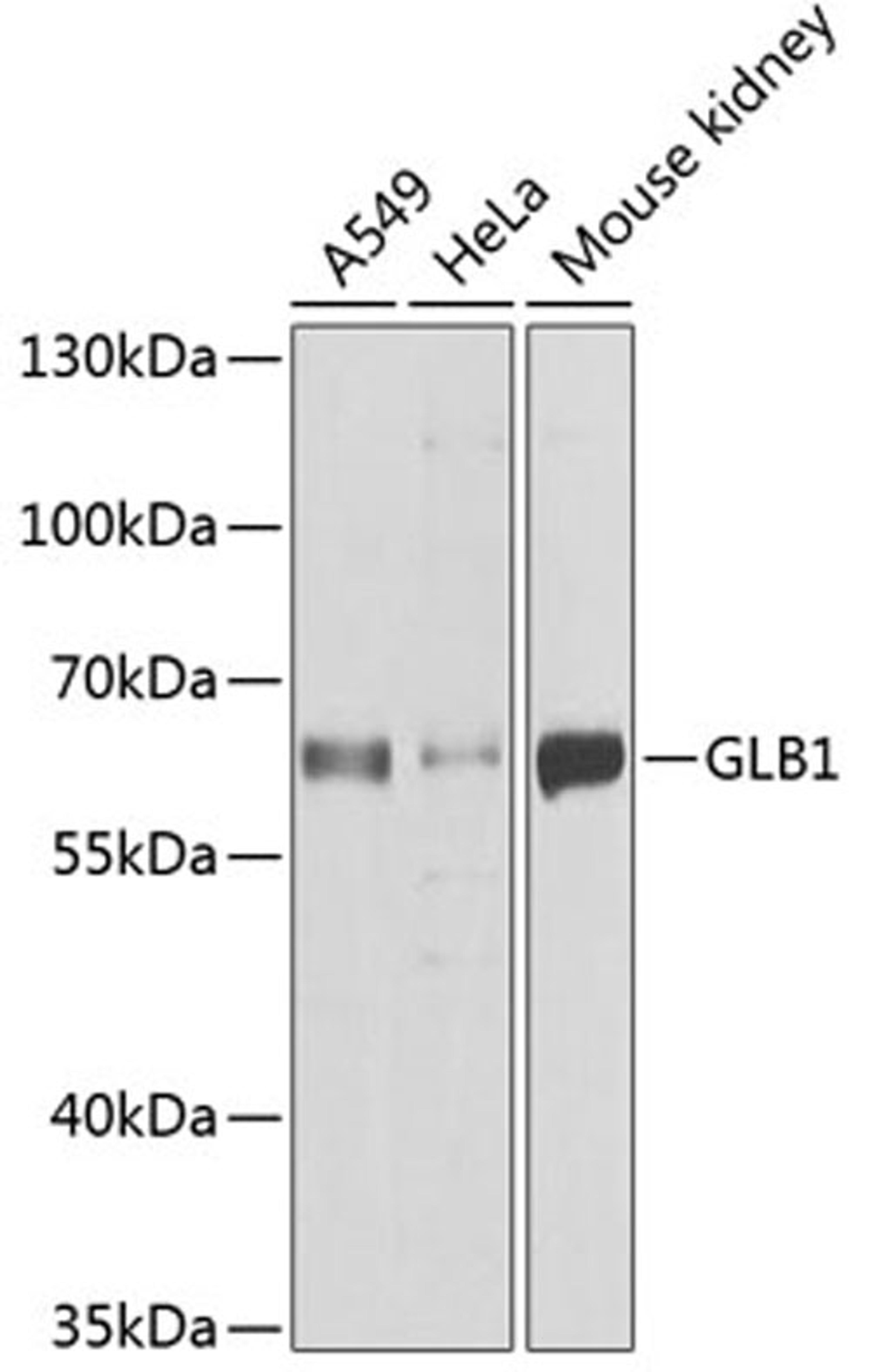 Western blot - GLB1 antibody (A1863)