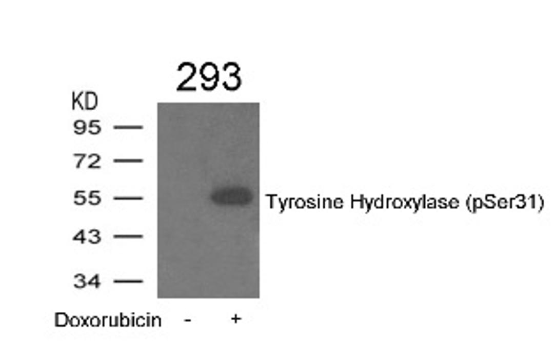 Western blot analysis of lysed extracts from 293 cells treated with Doxorubicin using Tyrosine Hydroxylase (Phospho-Ser31).