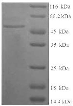 (Tris-Glycine gel) Discontinuous SDS-PAGE (reduced) with 5% enrichment gel and 15% separation gel.