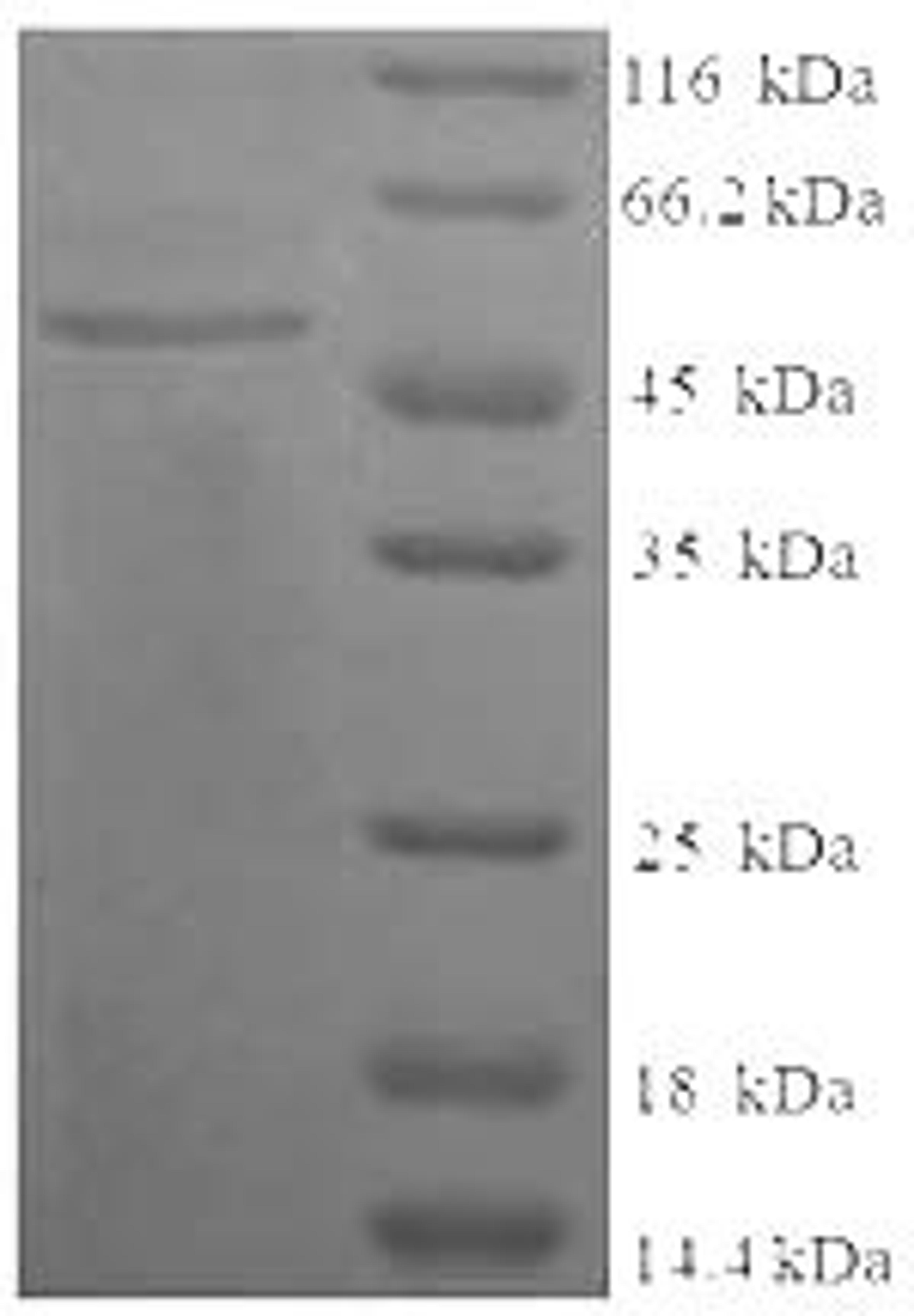 (Tris-Glycine gel) Discontinuous SDS-PAGE (reduced) with 5% enrichment gel and 15% separation gel.