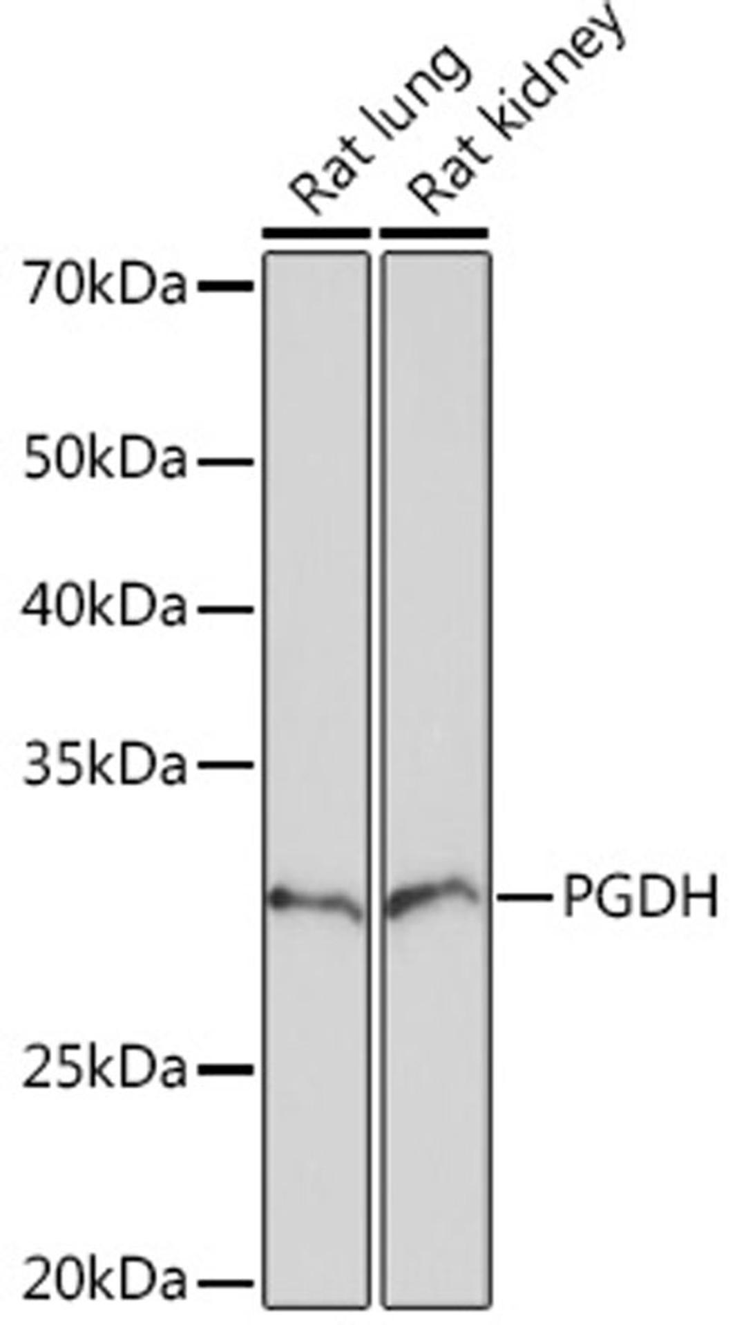 Western blot - PGDH Rabbit mAb (A5024)