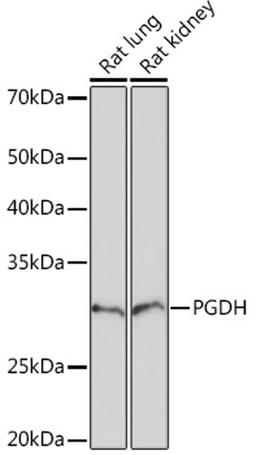 Western blot - PGDH Rabbit mAb (A5024)