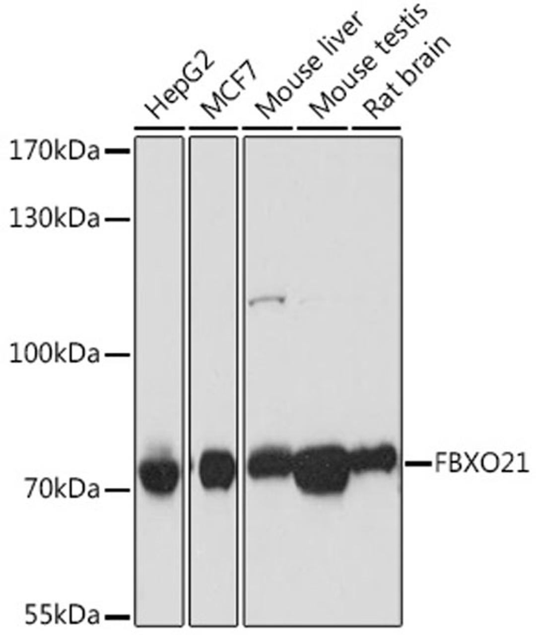 Western blot - FBXO21 antibody (A16107)