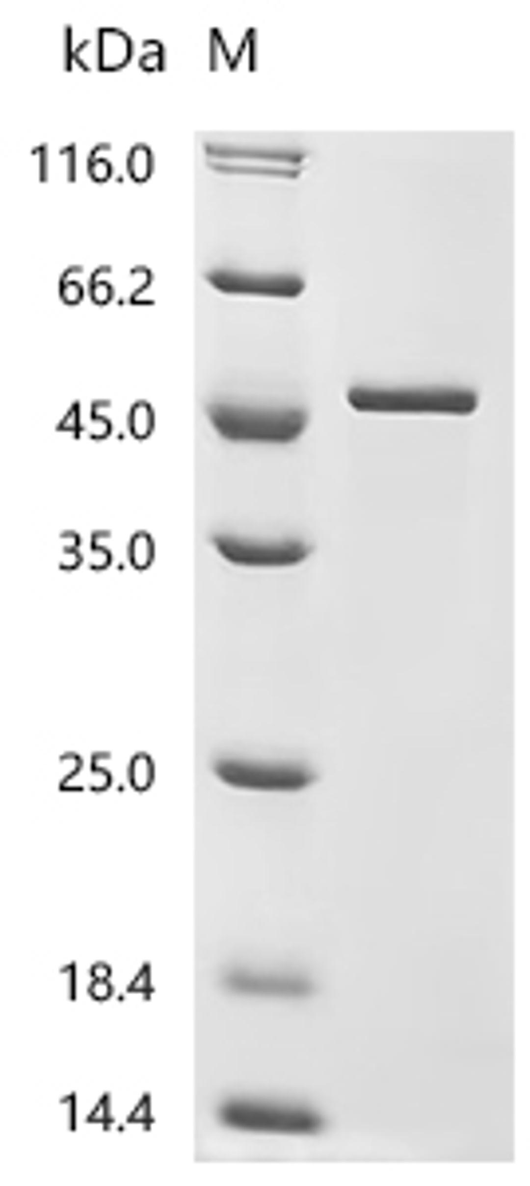 (Tris-Glycine gel) Discontinuous SDS-PAGE (reduced) with 5% enrichment gel and 15% separation gel.