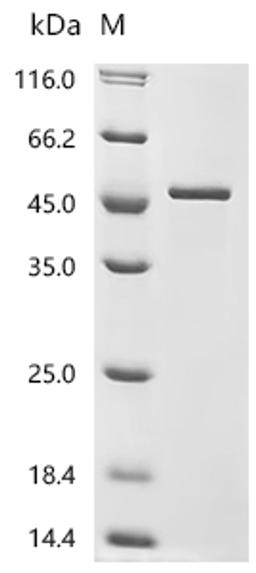 (Tris-Glycine gel) Discontinuous SDS-PAGE (reduced) with 5% enrichment gel and 15% separation gel.