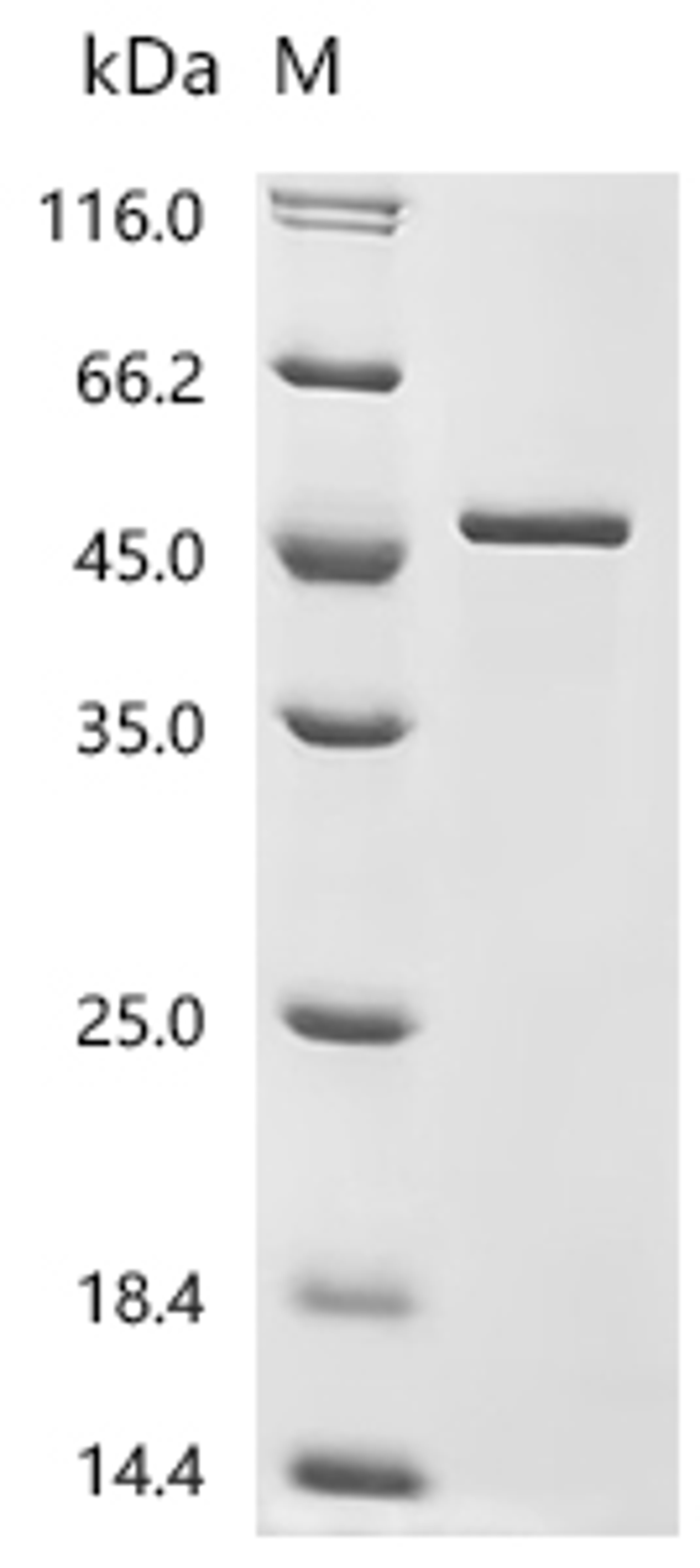 (Tris-Glycine gel) Discontinuous SDS-PAGE (reduced) with 5% enrichment gel and 15% separation gel.