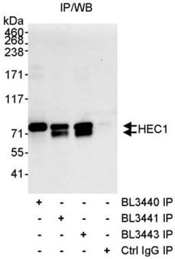 Detection of human HEC1 by western blot of immunoprecipitates.