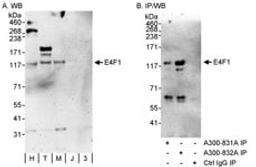 Detection of human E4F1 by western blot and immunoprecipitation.