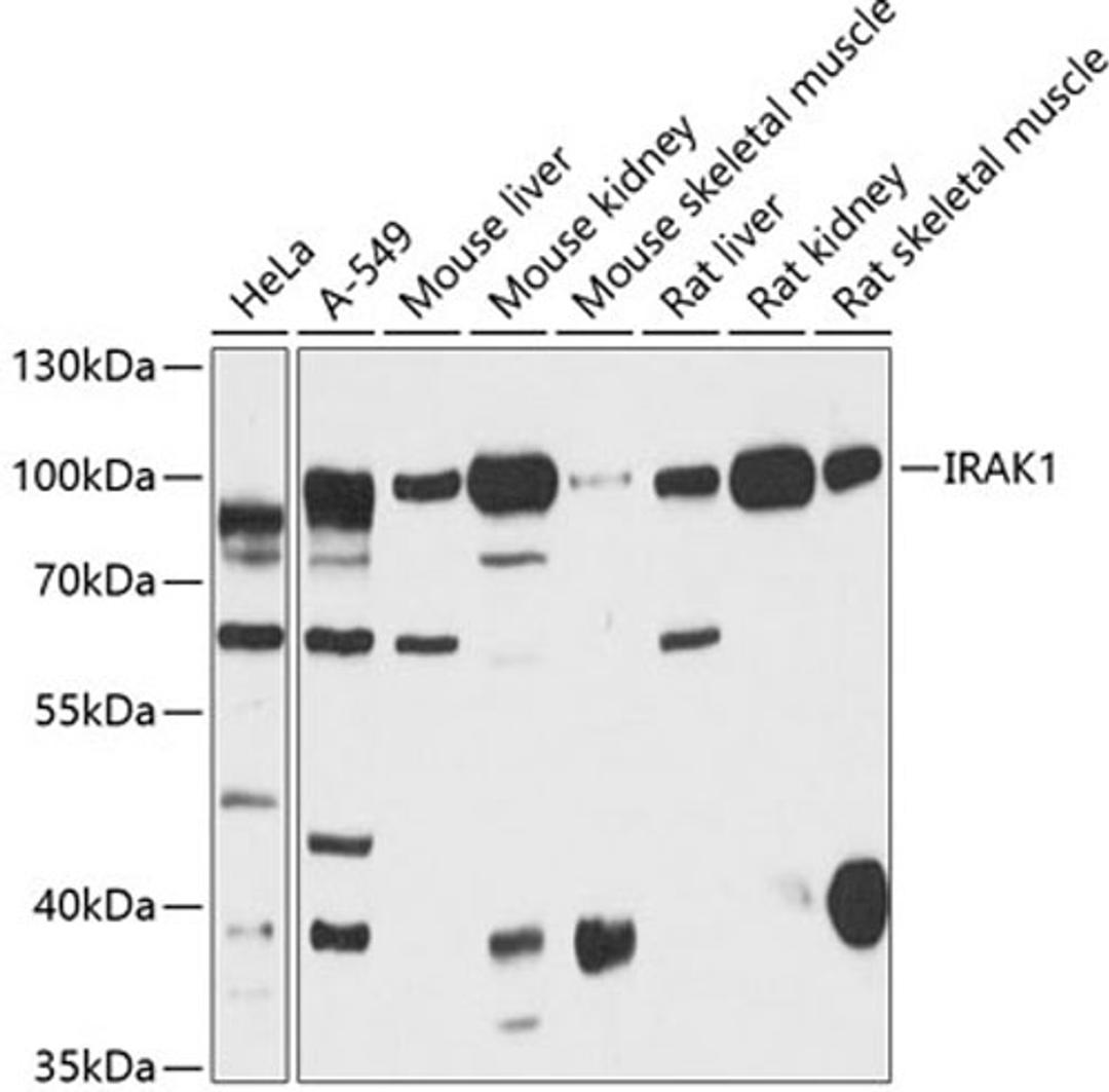 Western blot - IRAK1 antibody (A12624)