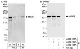 Detection of human and mouse MINK1 by western blot (h&m) and immunoprecipitation (h).