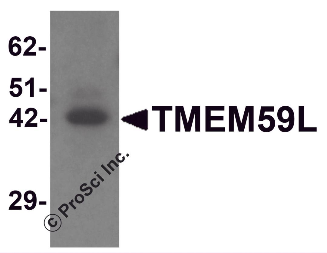 Western blot analysis of TMEM59L in rat heart tissue lysate with TMEM59L antibody at 1 &#956;g/mL.