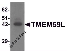 Western blot analysis of TMEM59L in rat heart tissue lysate with TMEM59L antibody at 1 &#956;g/mL.