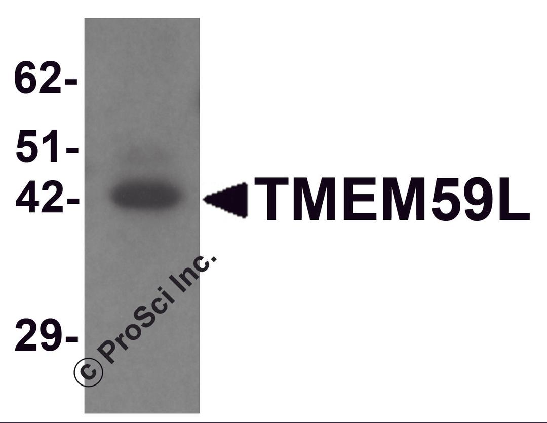 Western blot analysis of TMEM59L in rat heart tissue lysate with TMEM59L antibody at 1 μg/mL.