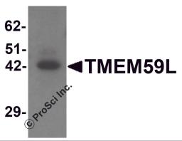 Western blot analysis of TMEM59L in rat heart tissue lysate with TMEM59L antibody at 1 μg/mL.