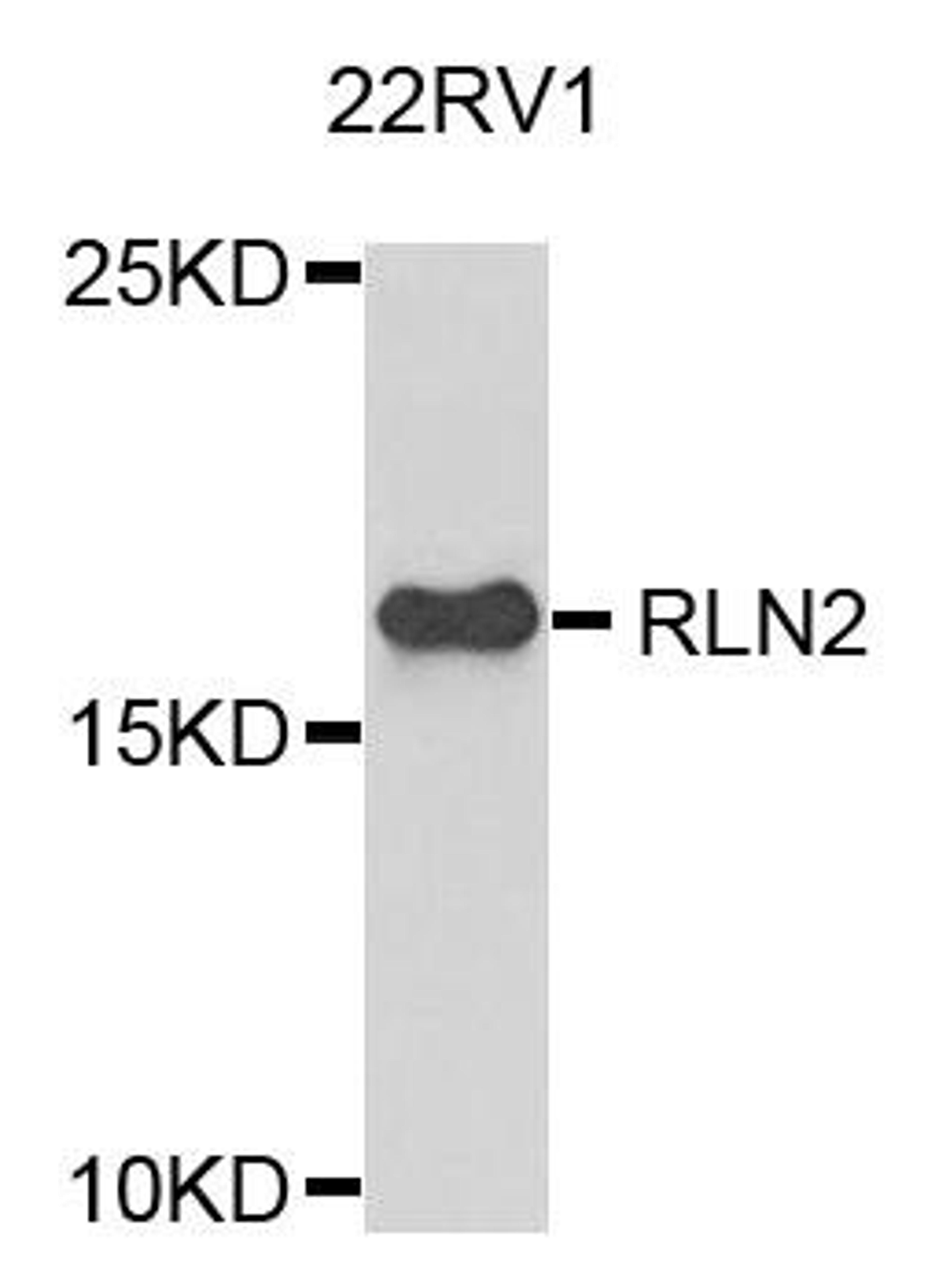 Western blot analysis of extracts of 22RV1 cells using RLN2 antibody