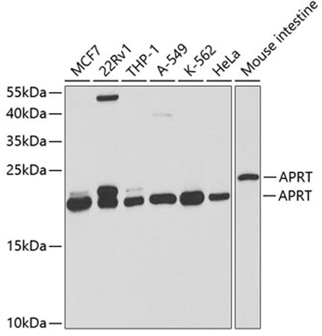 Western blot - APRT antibody (A5456)