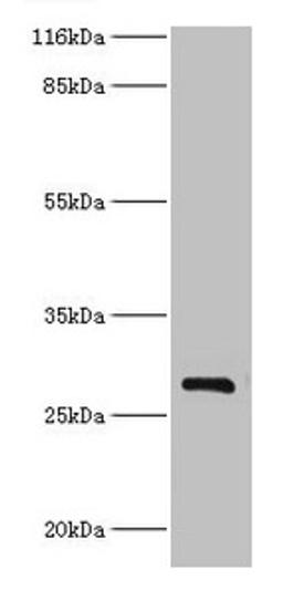 Western blot. All lanes: HSD17B14 antibody at 2µg/ml + Mouse kidney tissue. Secondary. Goat polyclonal to rabbit IgG at 1/10000 dilution. Predicted band size: 29 kDa. Observed band size: 29 kDa