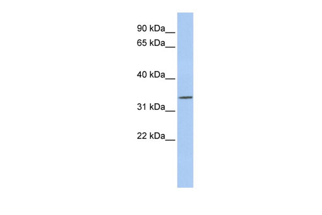 Antibody used in WB on Human MCF-7 at 0.2-1 ug/ml.