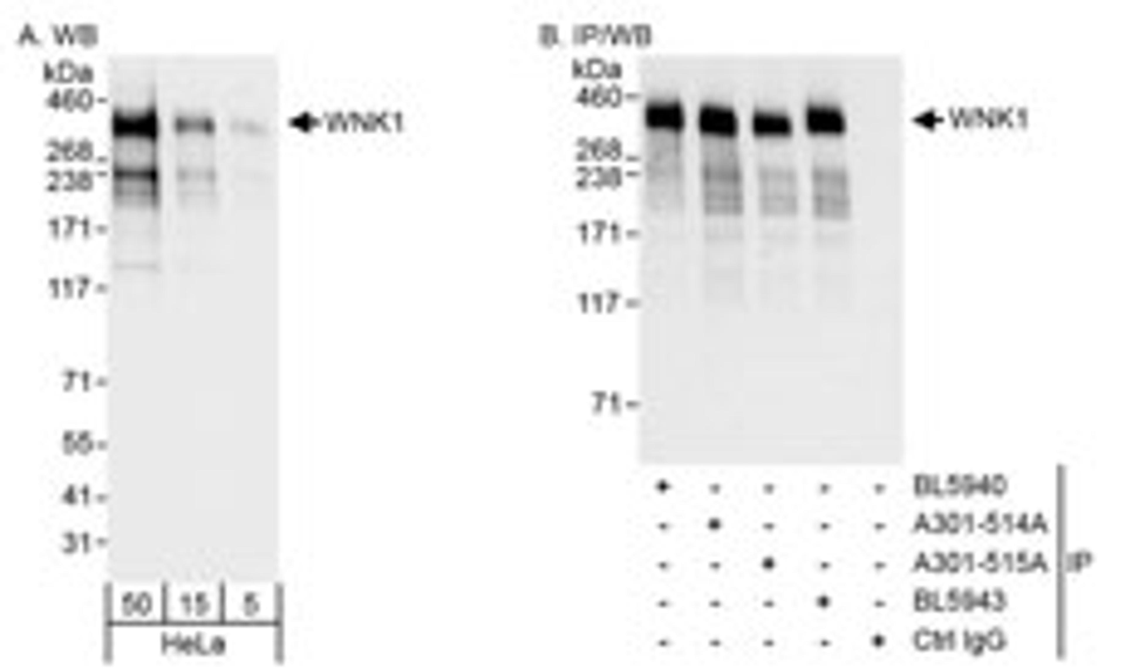 Detection of human WNK1 by western blot and immunoprecipitation.