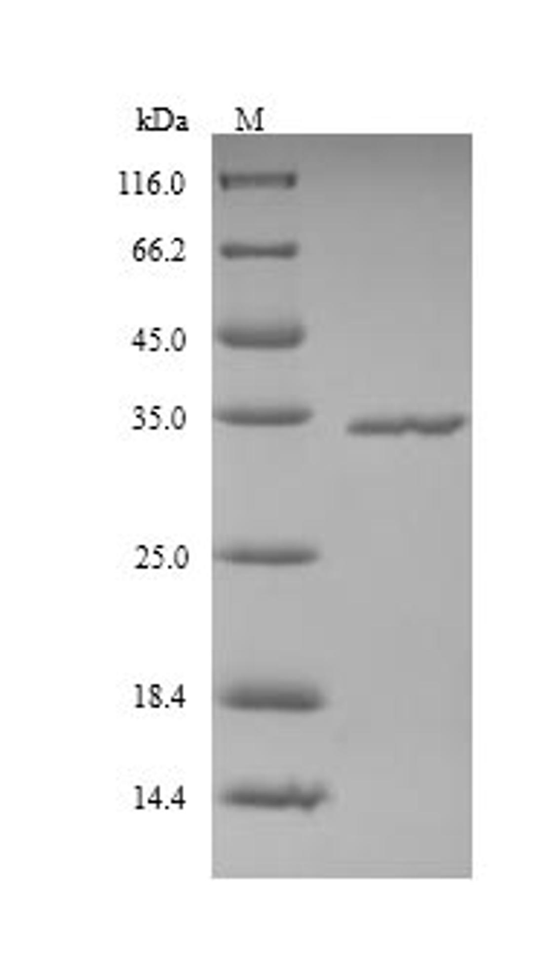 (Tris-Glycine gel) Discontinuous SDS-PAGE (reduced) with 5% enrichment gel and 15% separation gel.