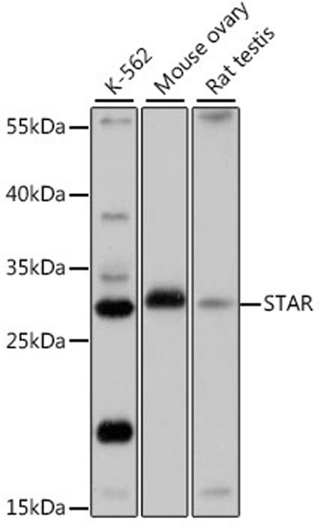 Western blot - STAR antibody (A16432)