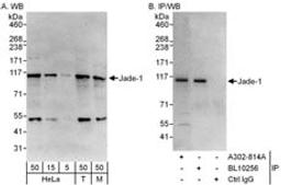 Detection of human and mouse Jade-1 by western blot (h&m) and immunoprecipitation (h).