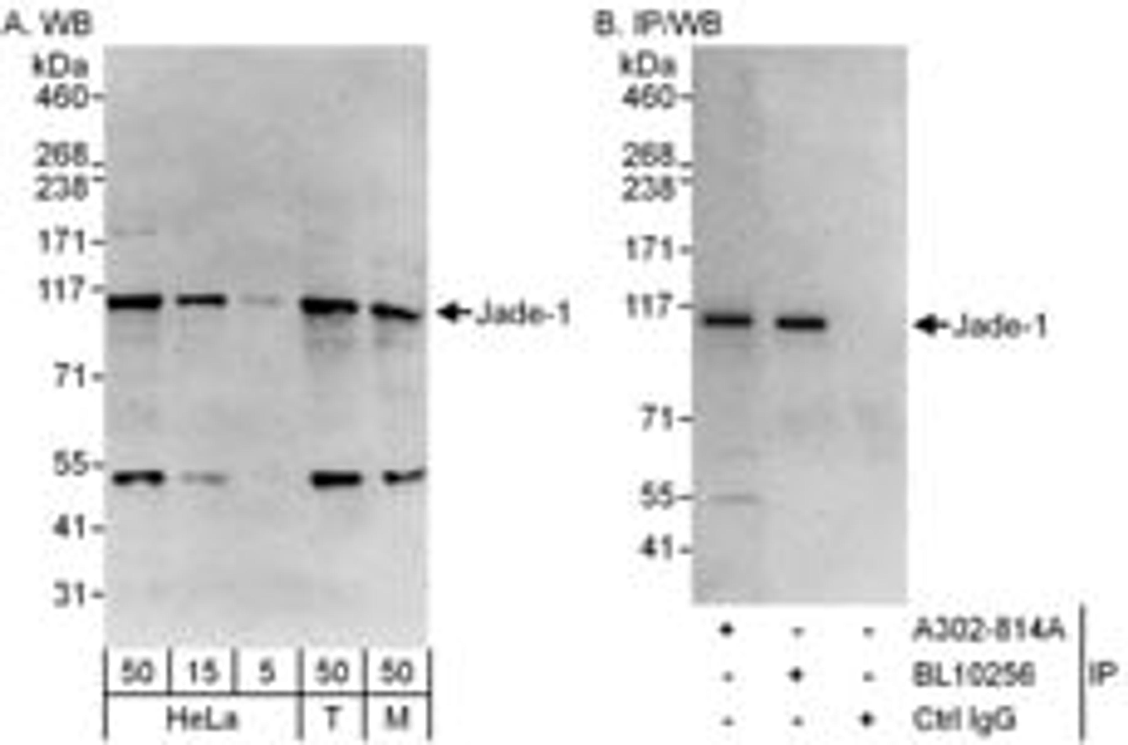 Detection of human and mouse Jade-1 by western blot (h&m) and immunoprecipitation (h).