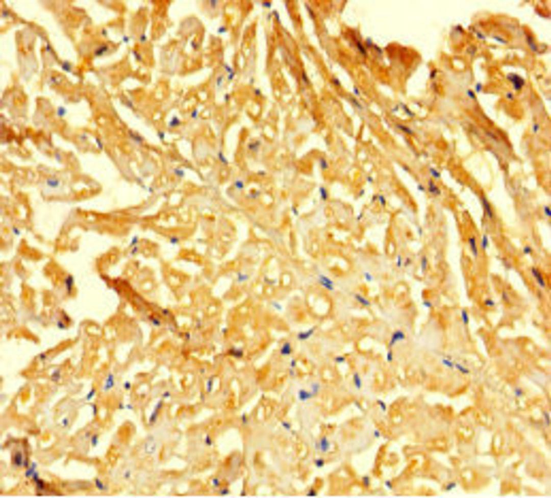 Immunohistochemistry of paraffin-embedded human heart tissue using CSB-PA008815HA01HU at dilution of 1:100