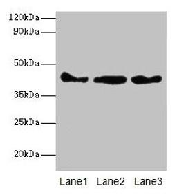 Western blot. All lanes: Actb antibody at 2µg/ml. Lane 1: Mouse spleen tissue. Lane 2: 293T whole cell lysate. Lane 3: Hela whole cell lysate. Secondary. Goat polyclonal to rabbit IgG at 1/10000 dilution. Predicted band size: 42 kDa. Observed band size: 42 kDa