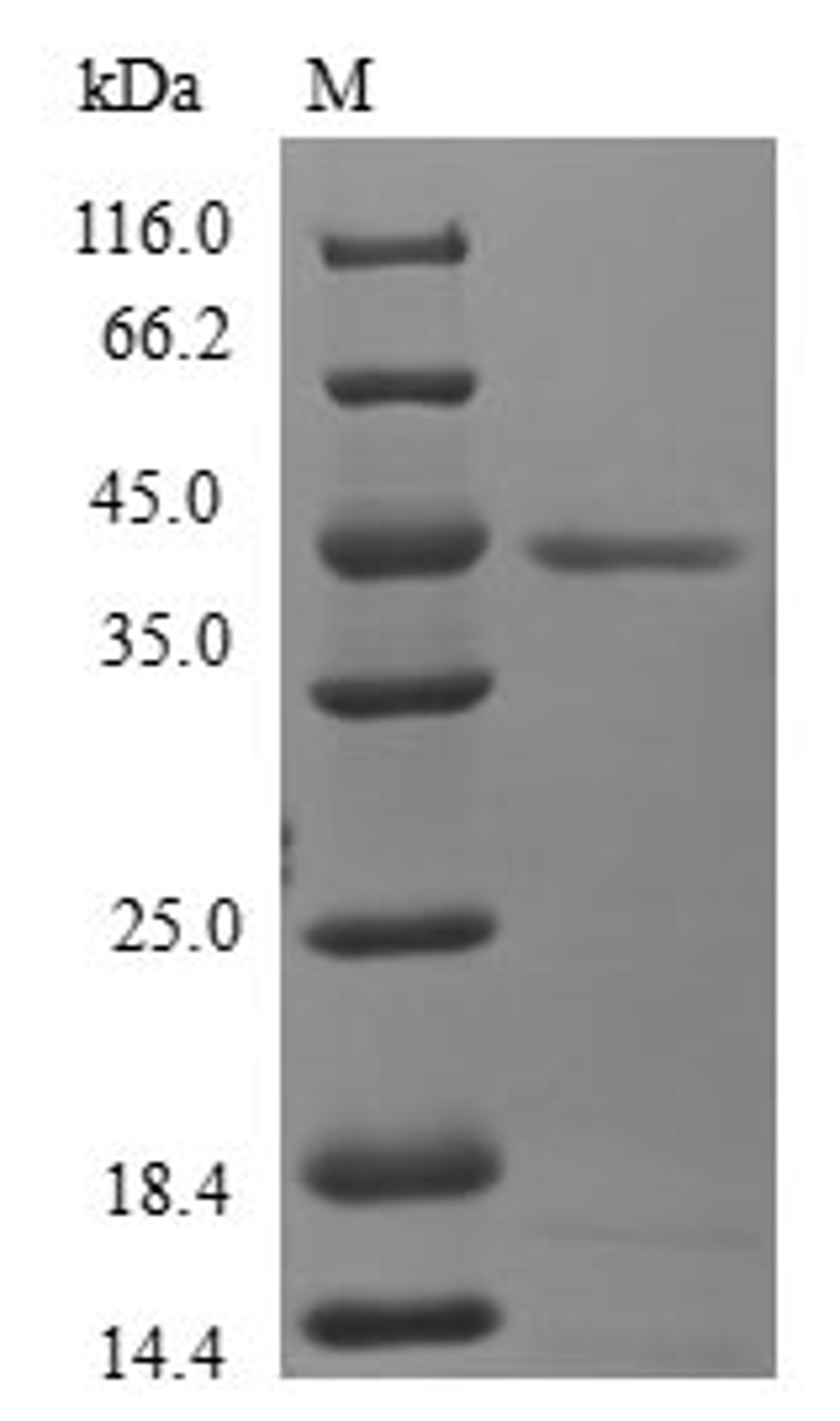 (Tris-Glycine gel) Discontinuous SDS-PAGE (reduced) with 5% enrichment gel and 15% separation gel.