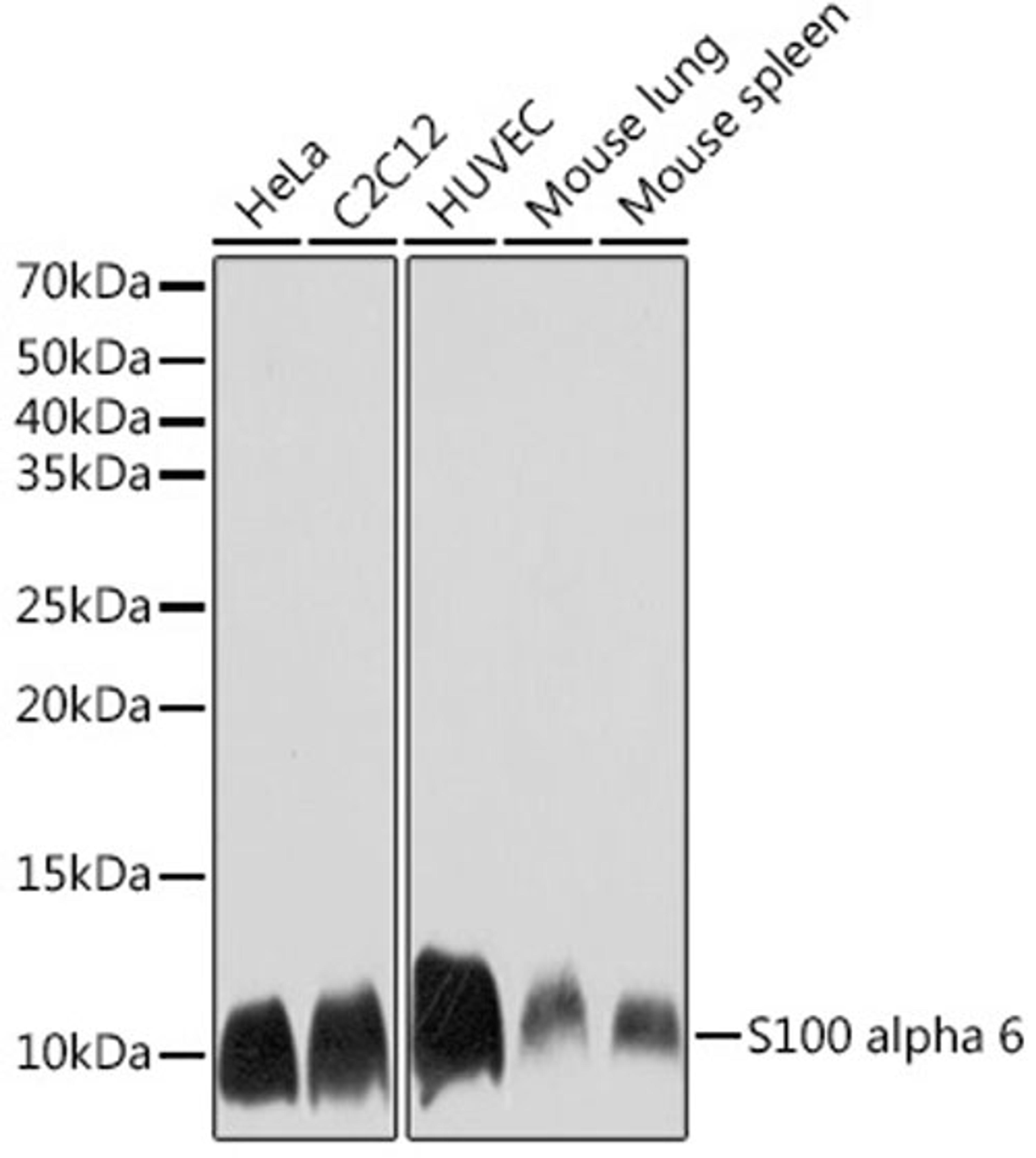 Western blot - S100 alpha 6 Rabbit mAb (A3461)