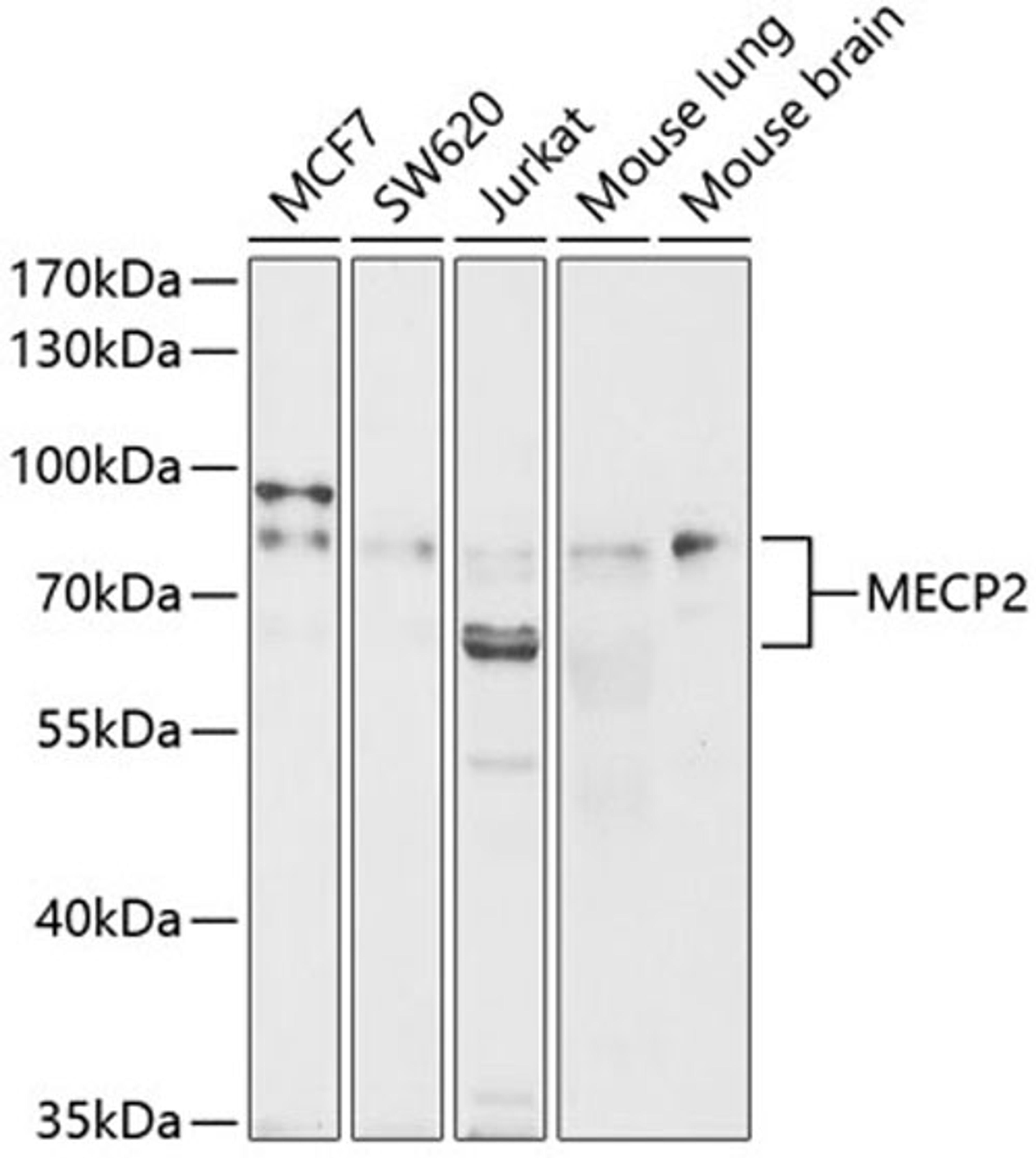 Western blot - MECP2 antibody (A0707)