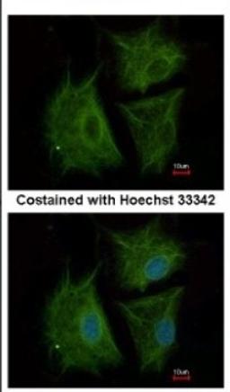 Immunocytochemistry/Immunofluorescence: CBCP6 Antibody [NBP2-15729] - Immunofluorescence analysis of methanol-fixed A549, using antibody at 1:500 dilution.