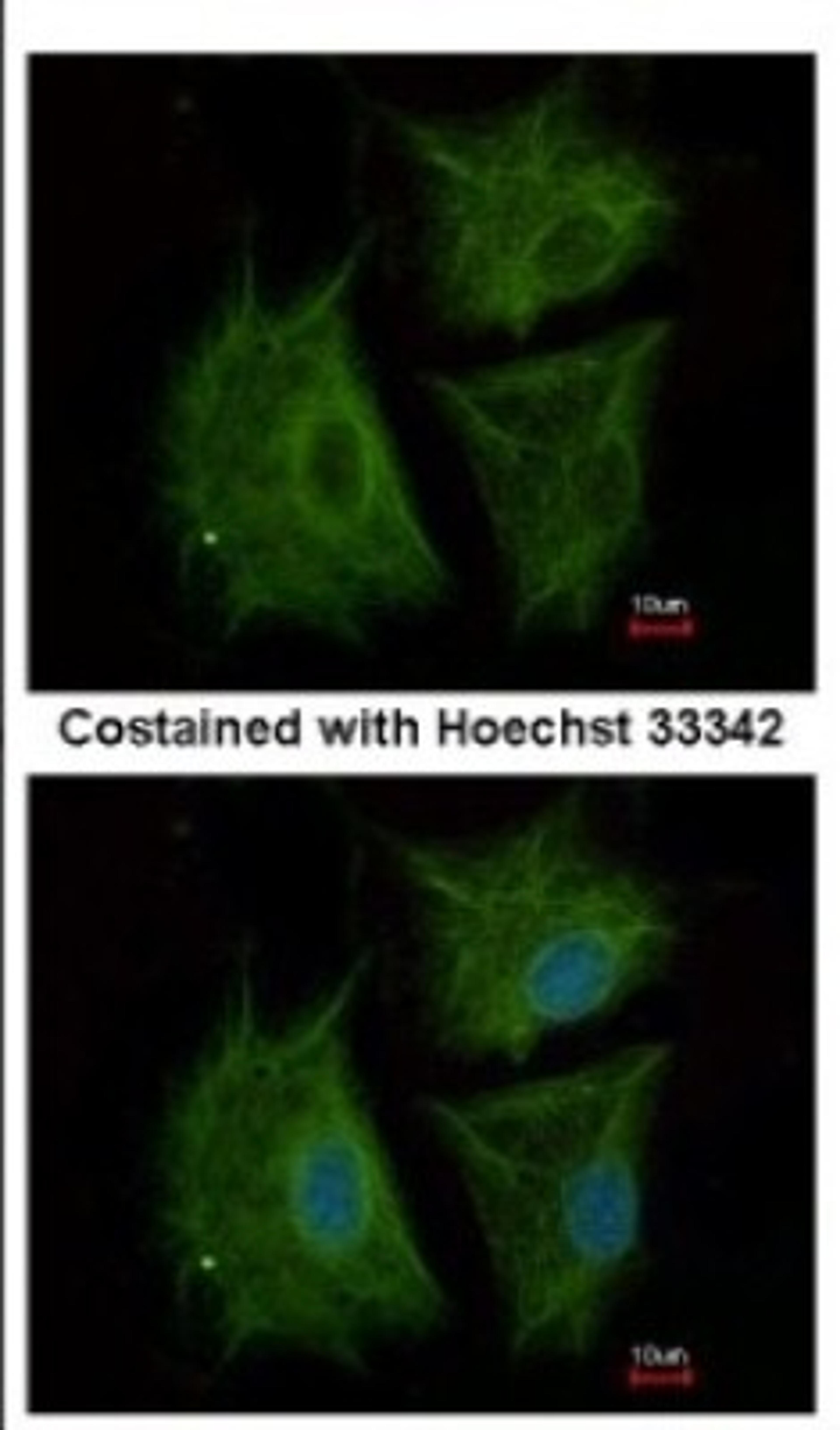 Immunocytochemistry/Immunofluorescence: CBCP6 Antibody [NBP2-15729] - Immunofluorescence analysis of methanol-fixed A549, using antibody at 1:500 dilution.