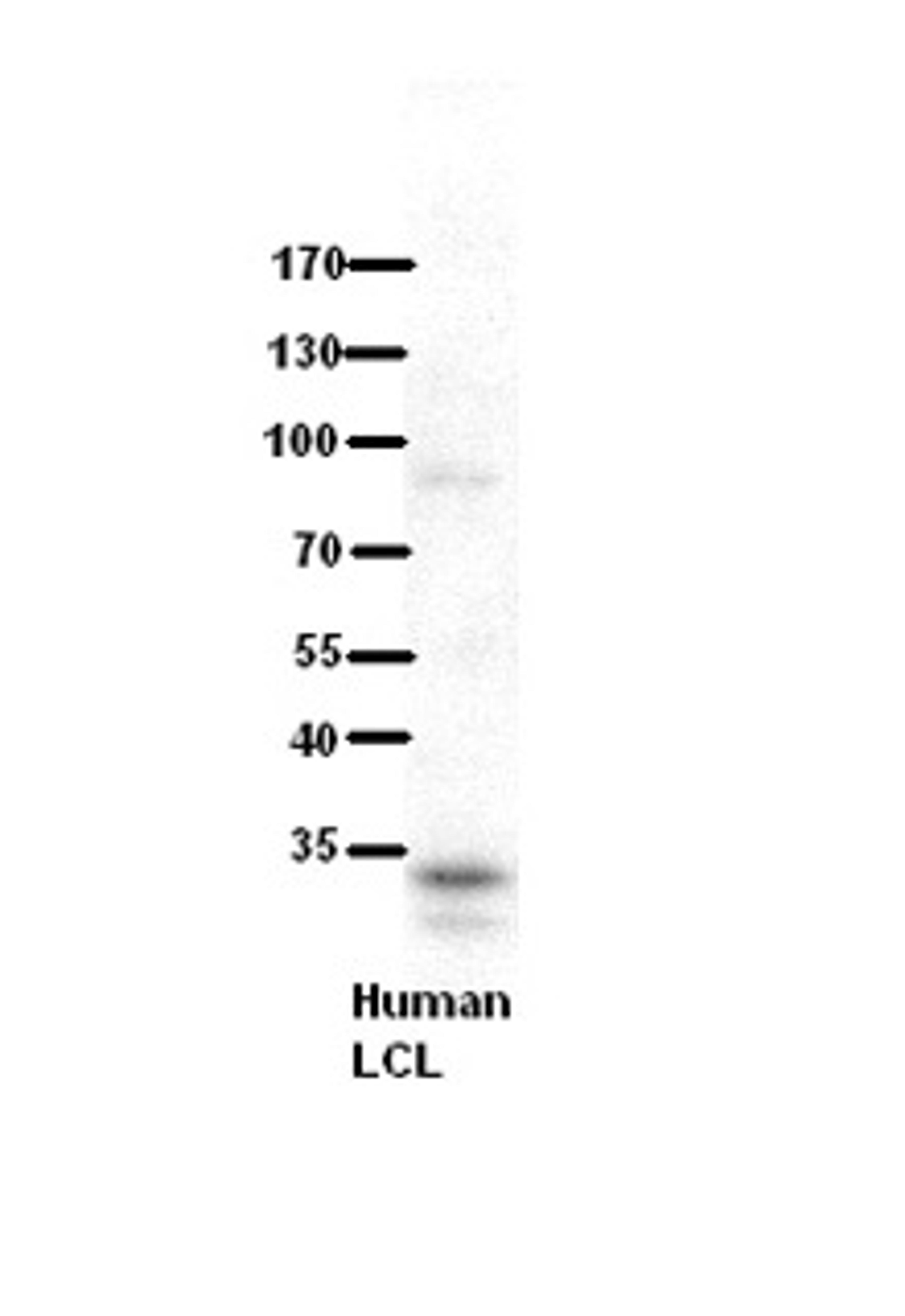 Antibody used in WB on human LCL at 1:500.