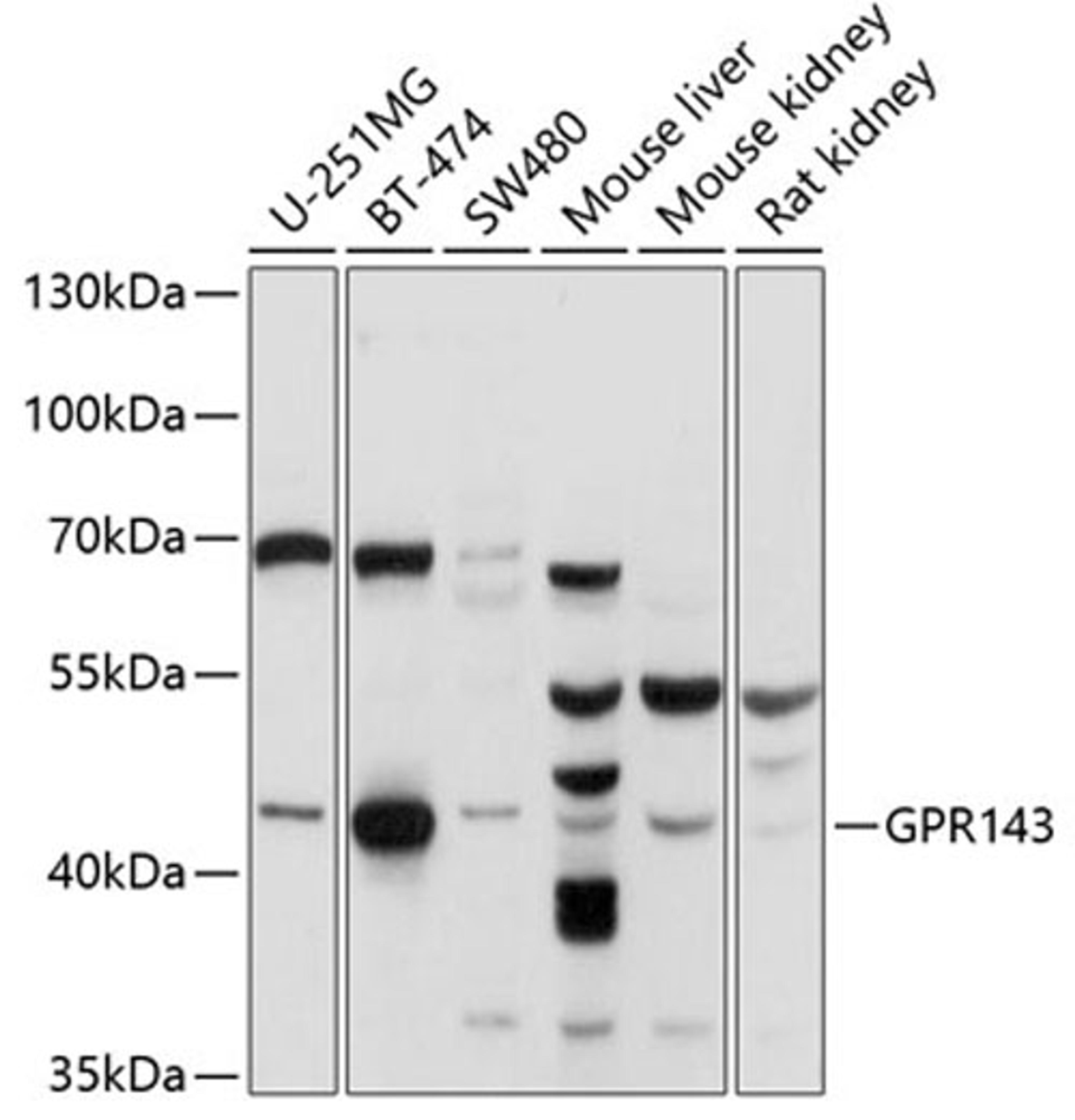 Western blot - GPR143 antibody (A10568)