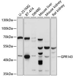 Western blot - GPR143 antibody (A10568)