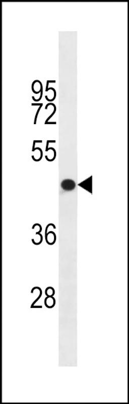 Western blot analysis in A2058 cell line lysates (35ug/lane).