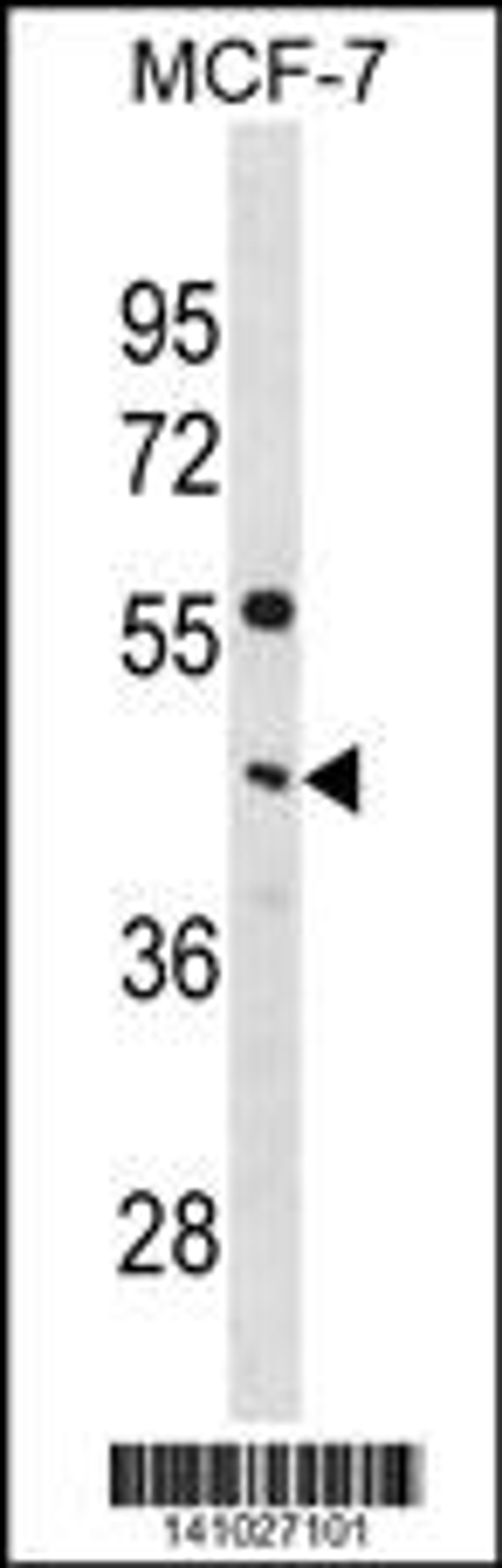 Western blot analysis in MCF-7 cell line lysates (35ug/lane).